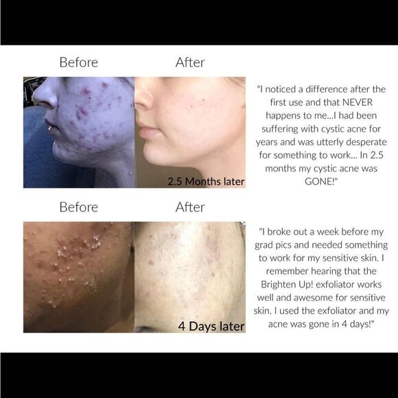 Vasanti BrightenUp! Exfoliator - Enzymatic Face Rejuvenator - Deluxe Sample 20g - Picture 15 of 16